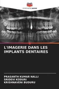 bokomslag L'Imagerie Dans Les Implants Dentaires