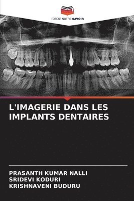 L'Imagerie Dans Les Implants Dentaires 1