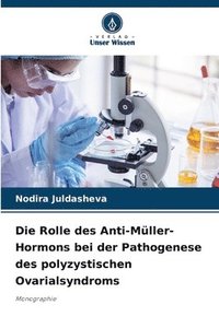 bokomslag Die Rolle des Anti-Mller-Hormons bei der Pathogenese des polyzystischen Ovarialsyndroms