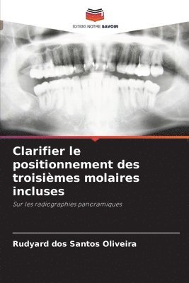 Clarifier le positionnement des troisimes molaires incluses 1