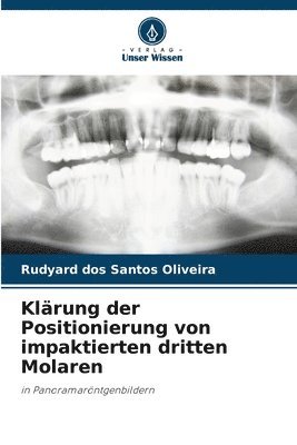 Klrung der Positionierung von impaktierten dritten Molaren 1