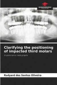 bokomslag Clarifying the positioning of impacted third molars