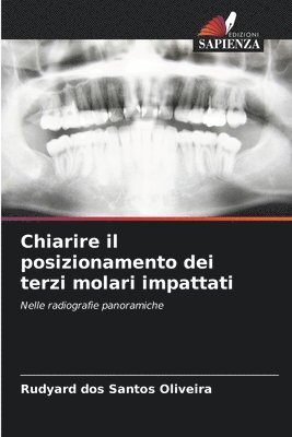 bokomslag Chiarire il posizionamento dei terzi molari impattati