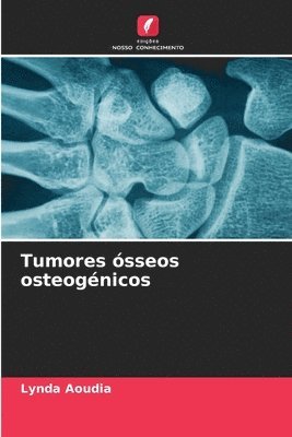 Tumores sseos osteognicos 1