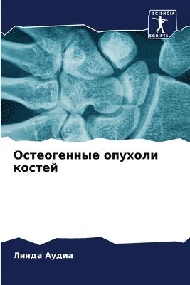 &#1054;&#1089;&#1090;&#1077;&#1086;&#1075;&#1077;&#1085;&#1085;&#1099;&#1077; &#1086;&#1087;&#1091;&#1093;&#1086;&#1083;&#1080; &#1082;&#1086;&#1089;&#1090;&#1077;&#1081; 1