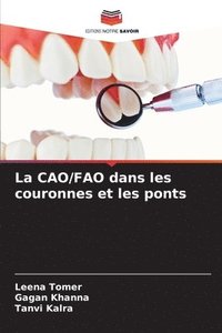 bokomslag La CAO/FAO dans les couronnes et les ponts