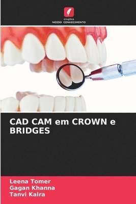 bokomslag CAD CAM em CROWN e BRIDGES