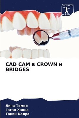 CAD CAM &#1074; Crown &#1080; Bridges 1