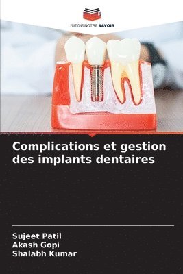 bokomslag Complications et gestion des implants dentaires