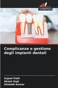 bokomslag Complicanze e gestione degli impianti dentali