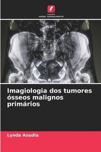 bokomslag Imagiologia dos tumores sseos malignos primrios