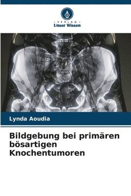 bokomslag Bildgebung bei primren bsartigen Knochentumoren