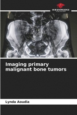 bokomslag Imaging primary malignant bone tumors