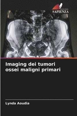 Imaging dei tumori ossei maligni primari 1