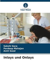 bokomslag Inlays und Onlays