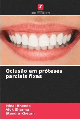 bokomslag Ocluso em prteses parciais fixas