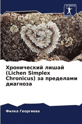 bokomslag &#1061;&#1088;&#1086;&#1085;&#1080;&#1095;&#1077;&#1089;&#1082;&#1080;&#1081; &#1083;&#1080;&#1096;&#1072;&#1081; (Lichen Simplex Chronicus) &#1079;&#1072;