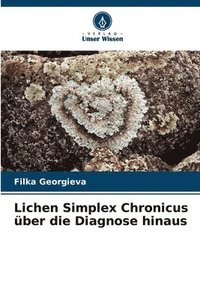 bokomslag Lichen Simplex Chronicus ber die Diagnose hinaus
