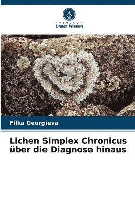 Lichen Simplex Chronicus ber die Diagnose hinaus 1