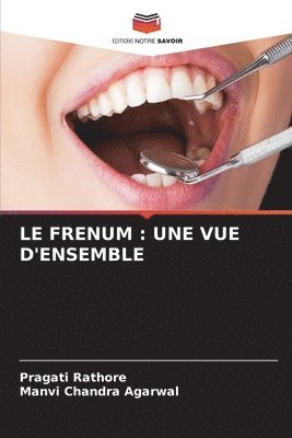 Le Frenum 1