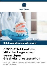 bokomslag CMCR-Effekt auf die Mikroleckage einer neuartigen Glashybridrestauration