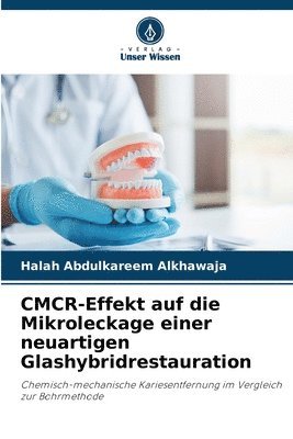 bokomslag CMCR-Effekt auf die Mikroleckage einer neuartigen Glashybridrestauration