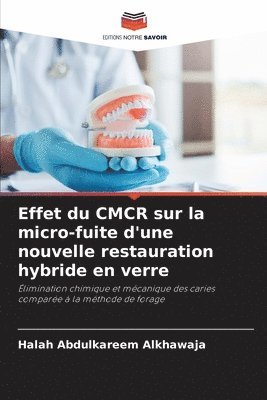 bokomslag Effet du CMCR sur la micro-fuite d'une nouvelle restauration hybride en verre