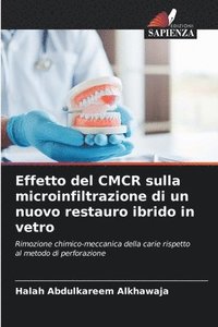 bokomslag Effetto del CMCR sulla microinfiltrazione di un nuovo restauro ibrido in vetro