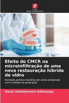 bokomslag Efeito do CMCR na microinfiltrao de uma nova restaurao hbrida de vidro