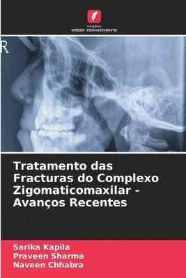 Tratamento das Fracturas do Complexo Zigomaticomaxilar - Avanos Recentes 1