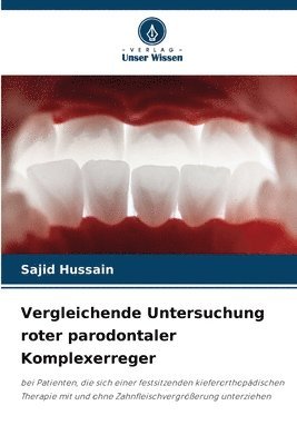 Vergleichende Untersuchung roter parodontaler Komplexerreger 1