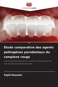 bokomslag tude comparative des agents pathognes parodontaux du complexe rouge