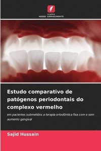 bokomslag Estudo comparativo de patgenos periodontais do complexo vermelho