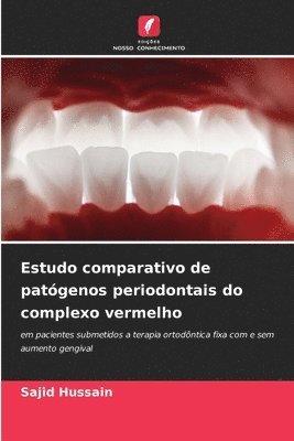 Estudo comparativo de patgenos periodontais do complexo vermelho 1