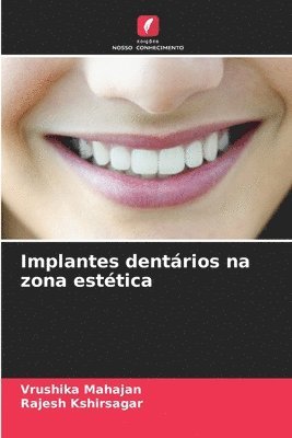 bokomslag Implantes dentrios na zona esttica