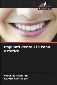 bokomslag Impianti dentali in zona estetica