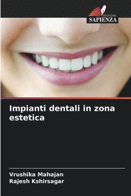 Impianti dentali in zona estetica 1