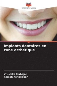 bokomslag Implants dentaires en zone esthtique