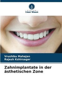 bokomslag Zahnimplantate in der sthetischen Zone