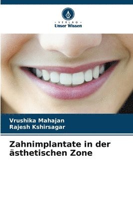 Zahnimplantate in der sthetischen Zone 1