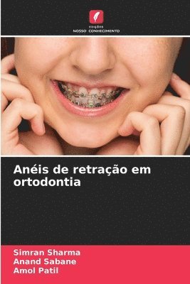 Anis de retrao em ortodontia 1