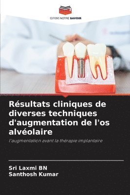 bokomslag Rsultats cliniques de diverses techniques d'augmentation de l'os alvolaire