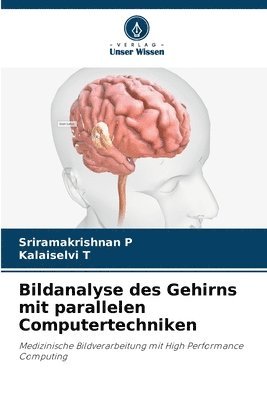 Bildanalyse des Gehirns mit parallelen Computertechniken 1