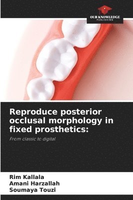 Reproduce posterior occlusal morphology in fixed prosthetics 1
