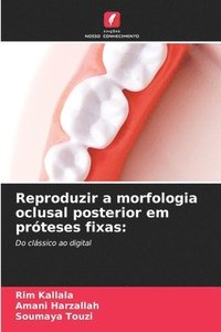 bokomslag Reproduzir a morfologia oclusal posterior em prteses fixas