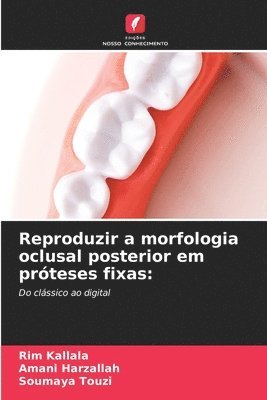 Reproduzir a morfologia oclusal posterior em prteses fixas 1