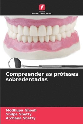 Modhupa Ghosh, Shilpa Shetty, Archana Shetty - Compreender as próteses sobredentadas, Häftad