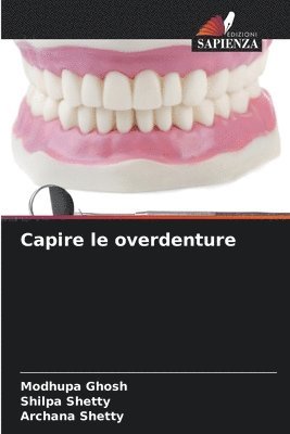 bokomslag Capire le overdenture