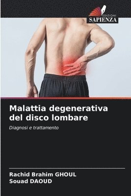 Malattia degenerativa del disco lombare 1