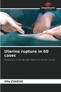 bokomslag Uterine rupture in 60 cases